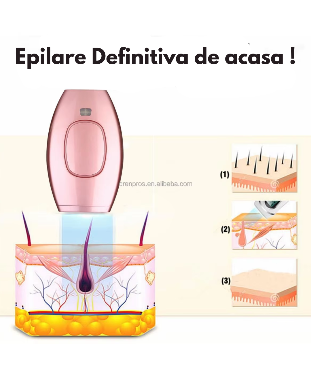 Epilator cu LASER